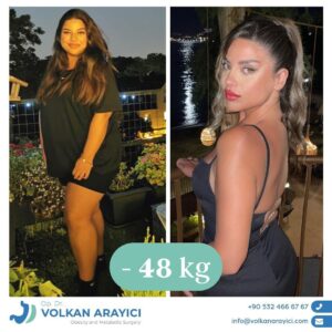Gewichtsreduktion Türkei beste klinik