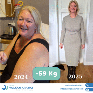 Schlauchmagen all inklusive Kosten