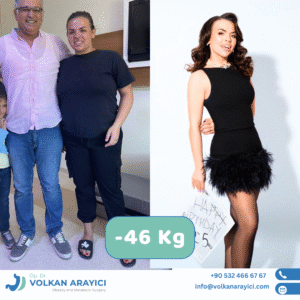 Vorteile der Schlauchmagen OP