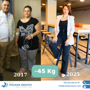 Schlauchmagen beste Klinik